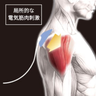局所的な電気筋肉刺激イメージ